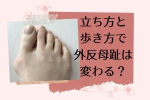 立ち方と歩き方で外反母趾は変わる 沖縄発 アフアフ 健康 ライフ